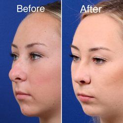 best of Plastic surgery and Facial