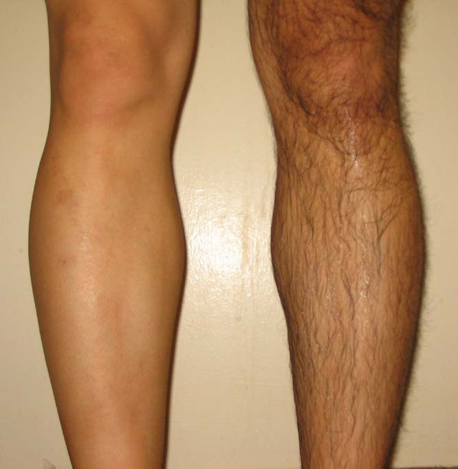 best of Shaved Leg man pic