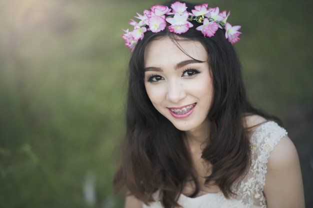 best of Braces Asian girl with