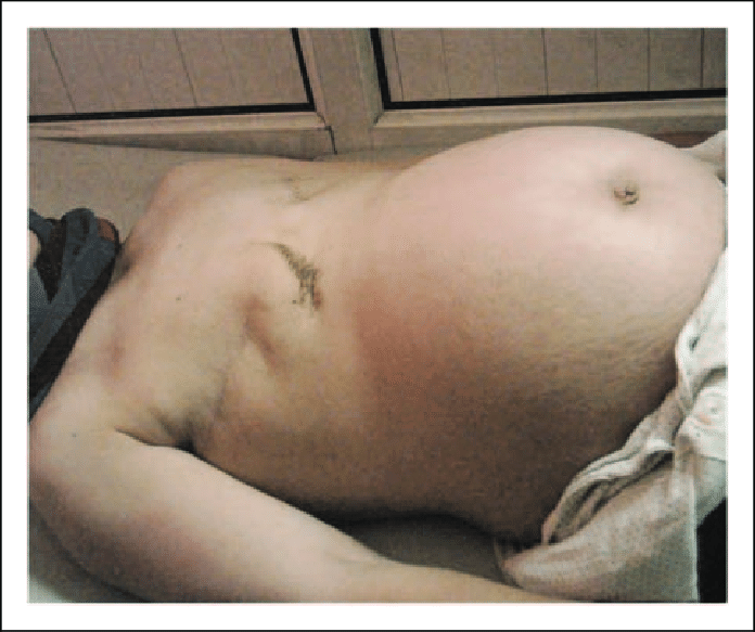 Breast picture pregnant woman