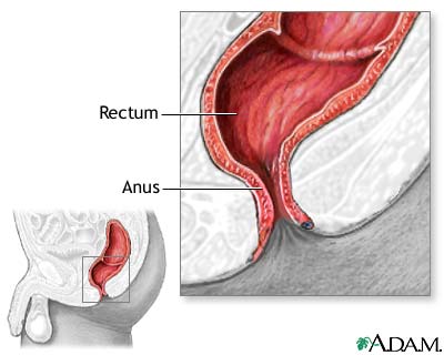 Red anus hemroids