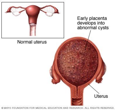 Chances of pregnancy partial penetration