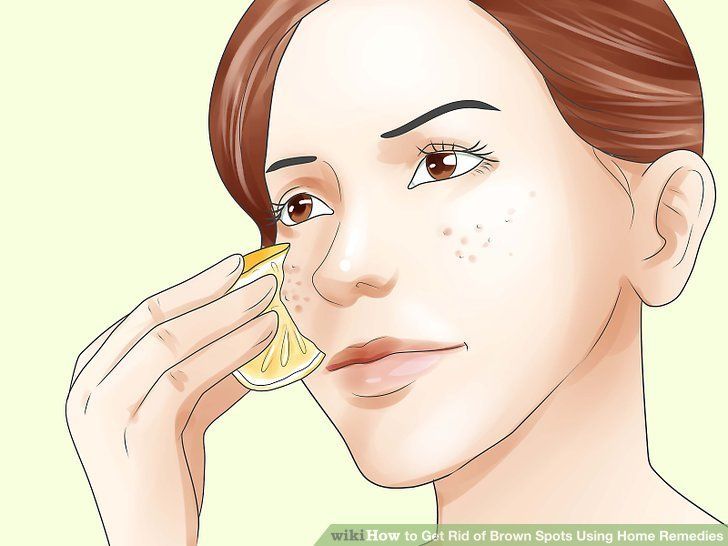 Getting rid of facial spots