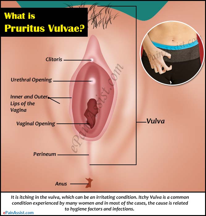 best of Causes and itching treatment Vulva