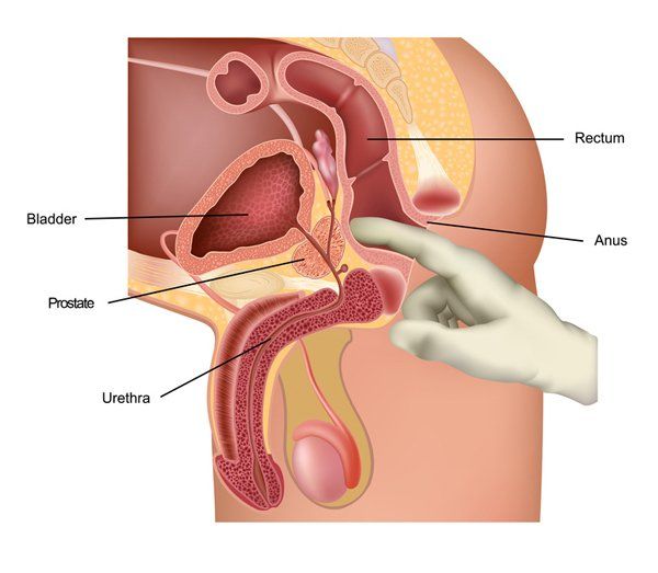 Prostate stimulation orgasm release