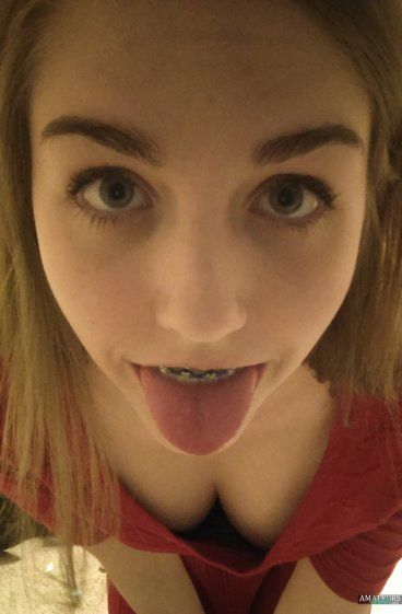 best of With Sexy braces teen