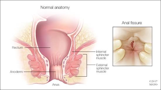 Exposed tissue through anus
