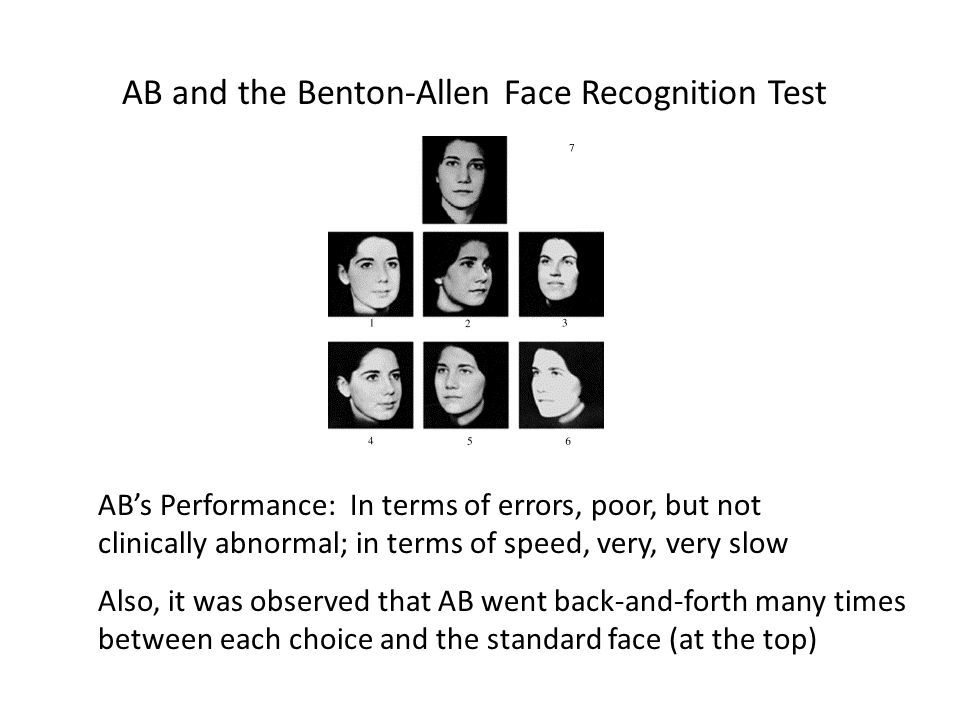Dream D. reccomend Benton facial recognition test