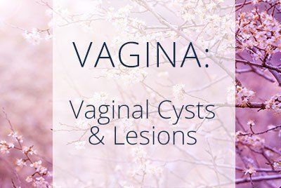 Brown S. reccomend Multiple cyst vagina
