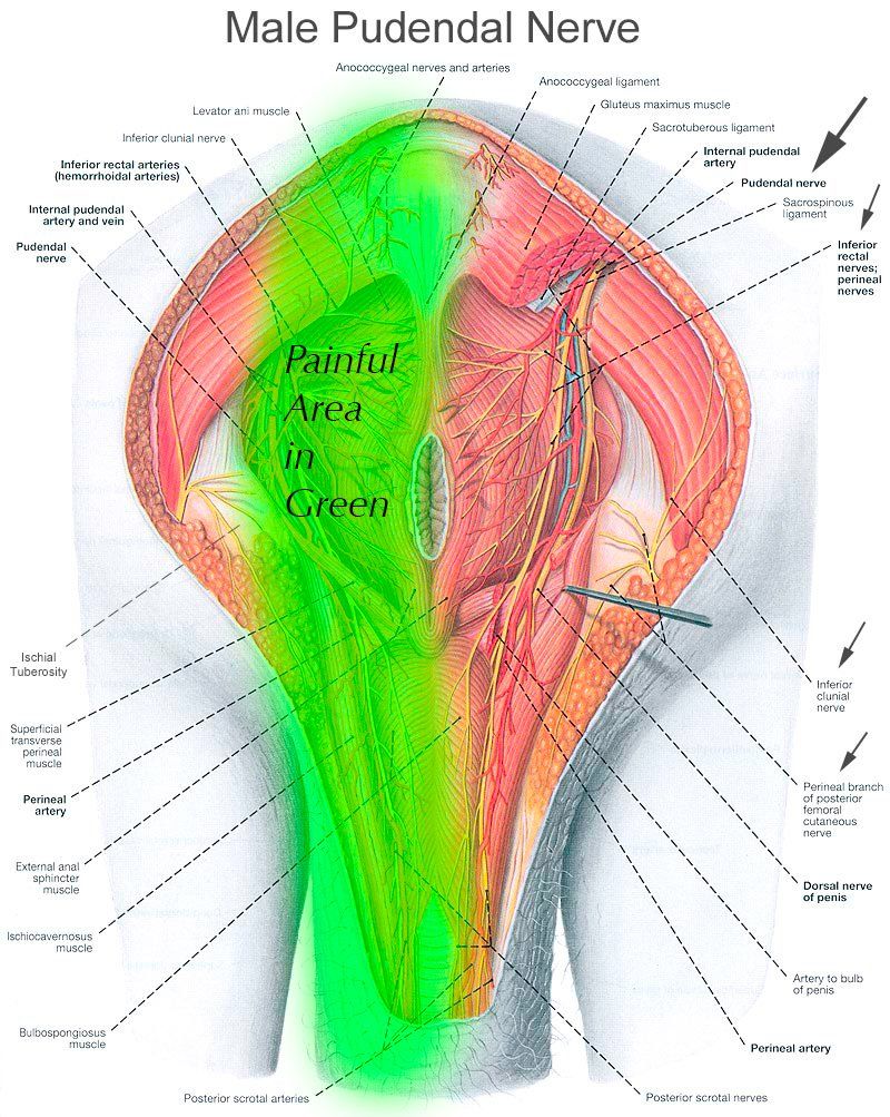 best of Herpetic of Post vulva neuralgia the