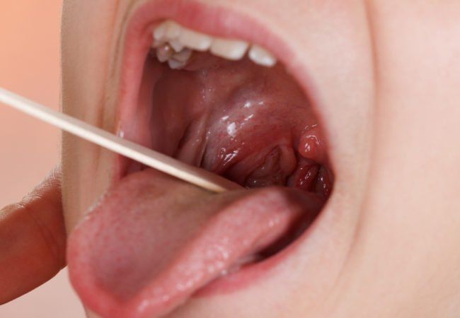 best of Sex throat before strep Oral three getting days
