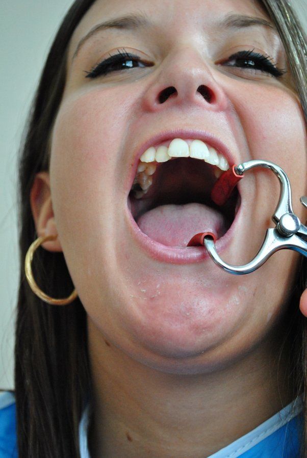 Dental mouth gag porn