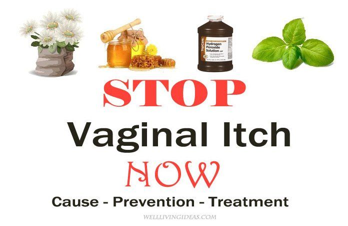 Vulva itching causes and treatment