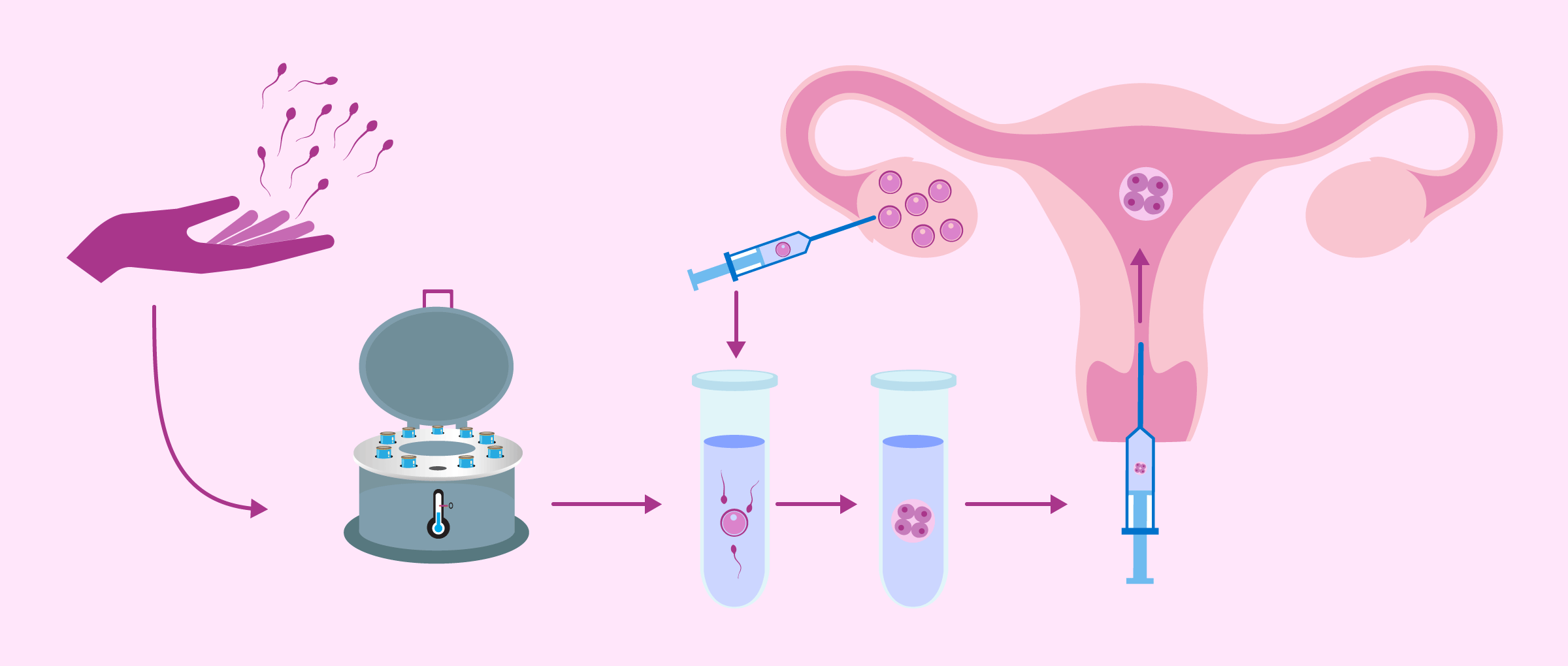 Sperm donation procedure