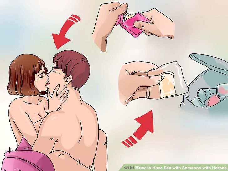 Hannibal reccomend How do you have sex step by step