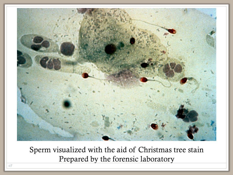 best of Stain Christmas for sperm tree