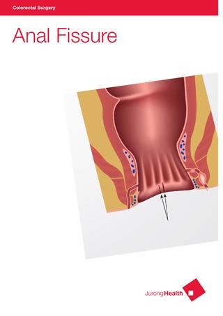 Twix reccomend Medical questions anus tear from bowel
