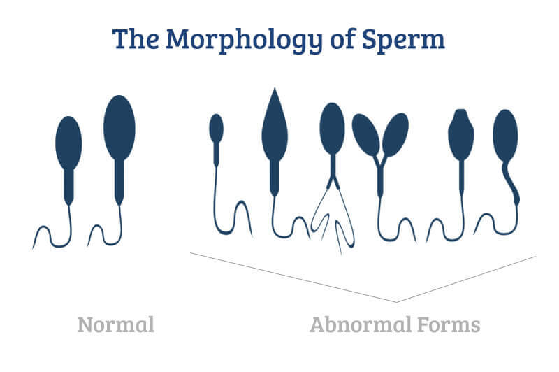 best of Durring ejaculation holding unhealthy Is sperm