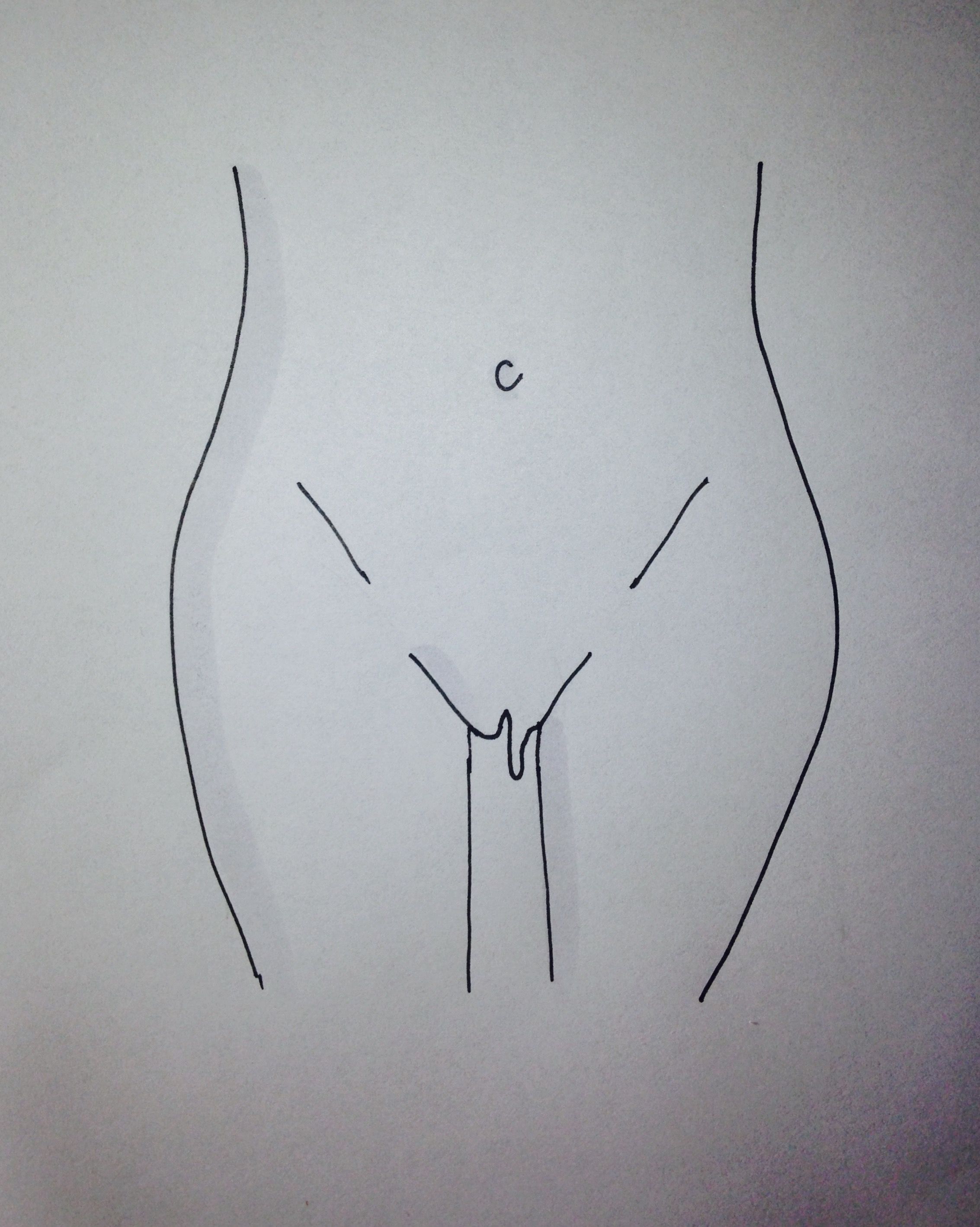 Different looking vulva