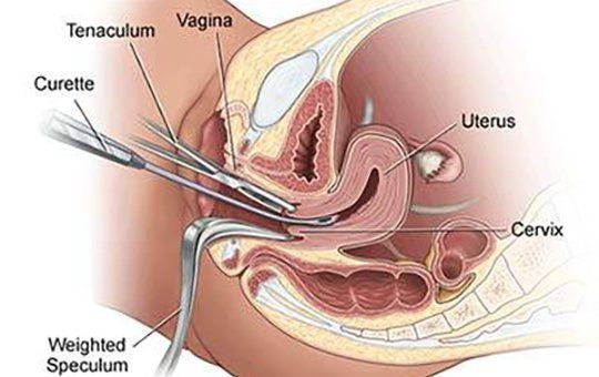 best of Surgery vagina D c