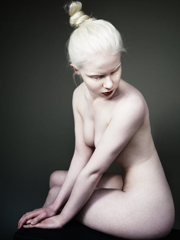 best of Naked Pictures albinos of