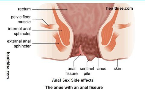 best of Return Anal normal sex size to