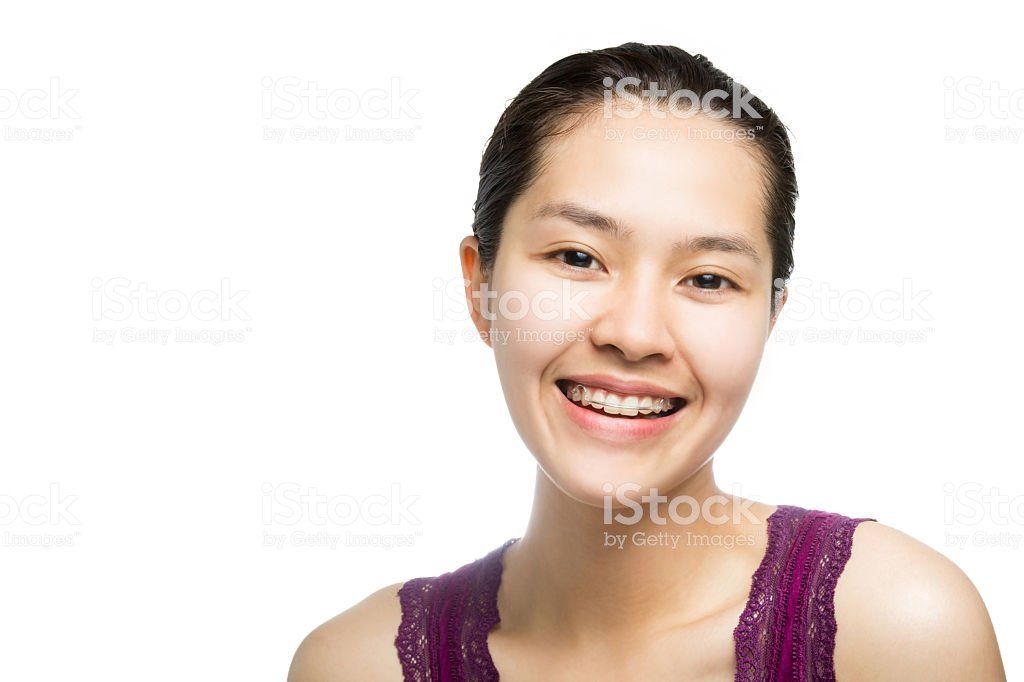 Asian girl with braces