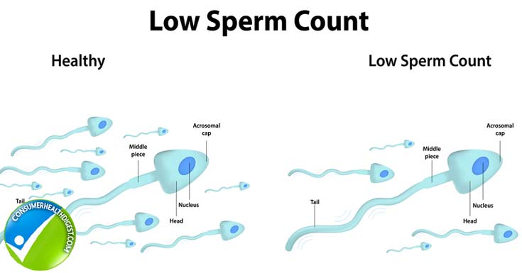 Beef reccomend Sperm and age