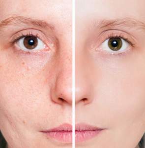 best of Sensitive facial skin Dry