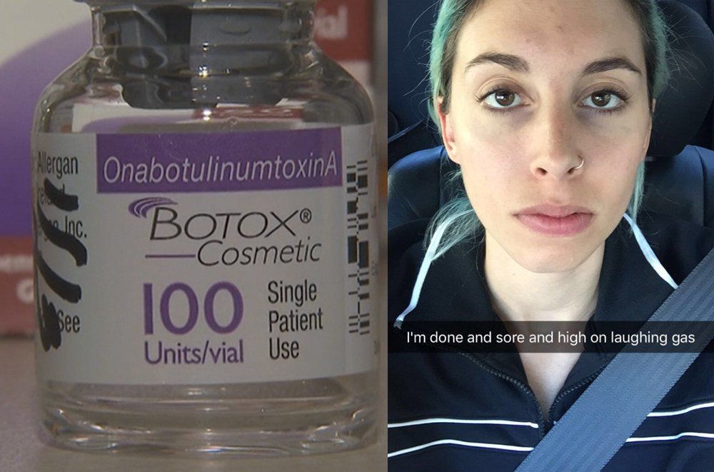 Dragonfly reccomend Botox in the vagina