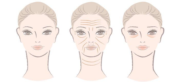 Combo reccomend Facial lines and wrinkles
