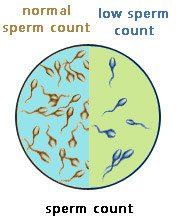 Shut O. reccomend Cause count in low man sperm