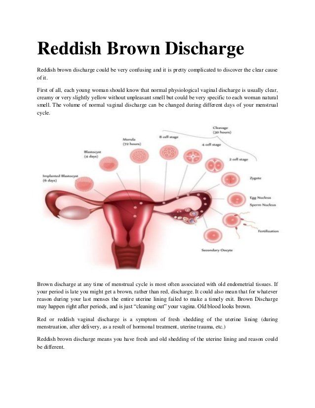 Dark discharge vagina
