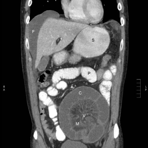 Zee-donk reccomend anus Ct colon scan