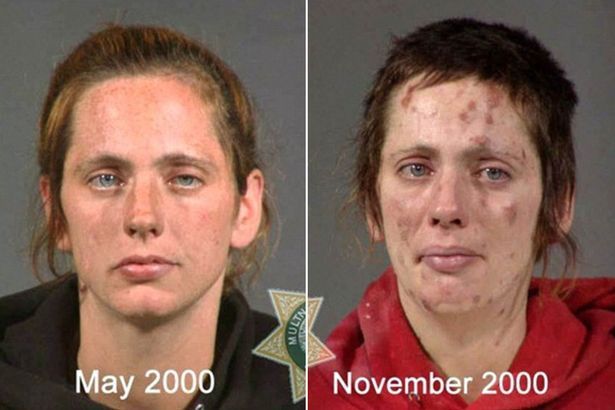 best of Facial rashes addiction and Drug
