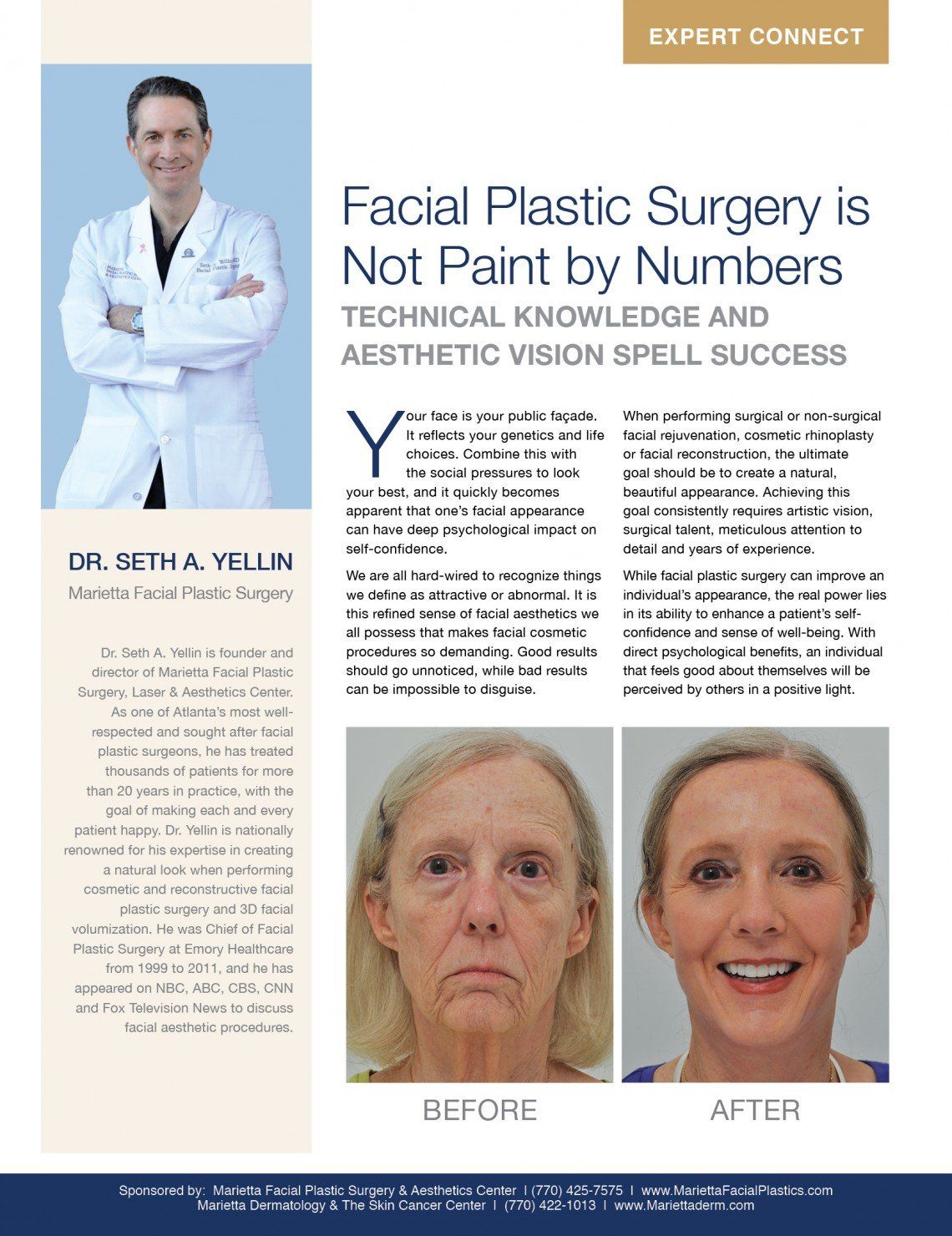 Georgia center for facial plastic surgery