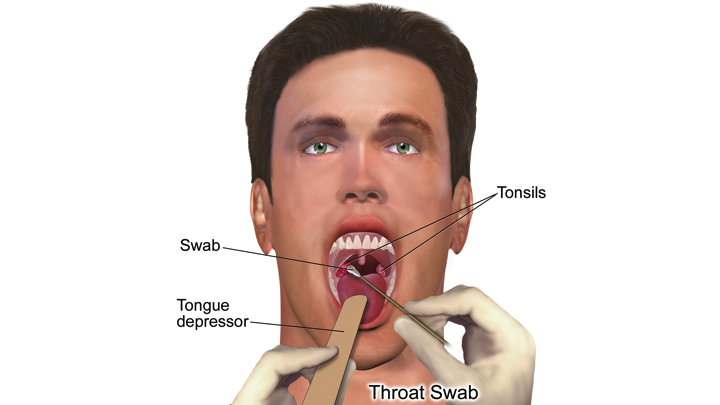 best of Sex throat before strep Oral three getting days