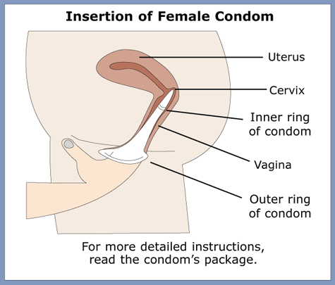 Cosmos reccomend Female condom girls por
