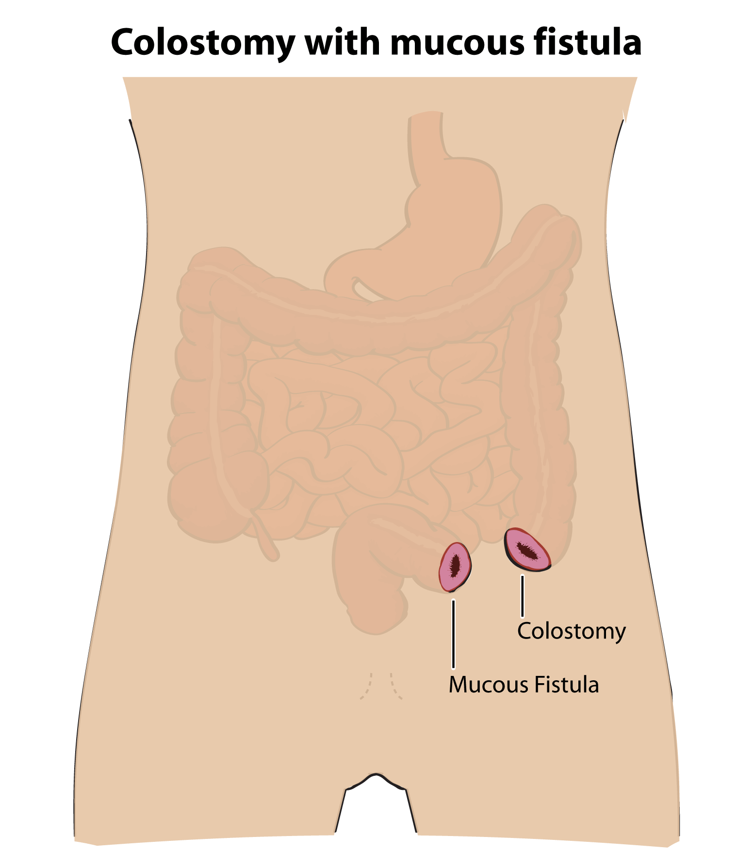 Glycerin on anus