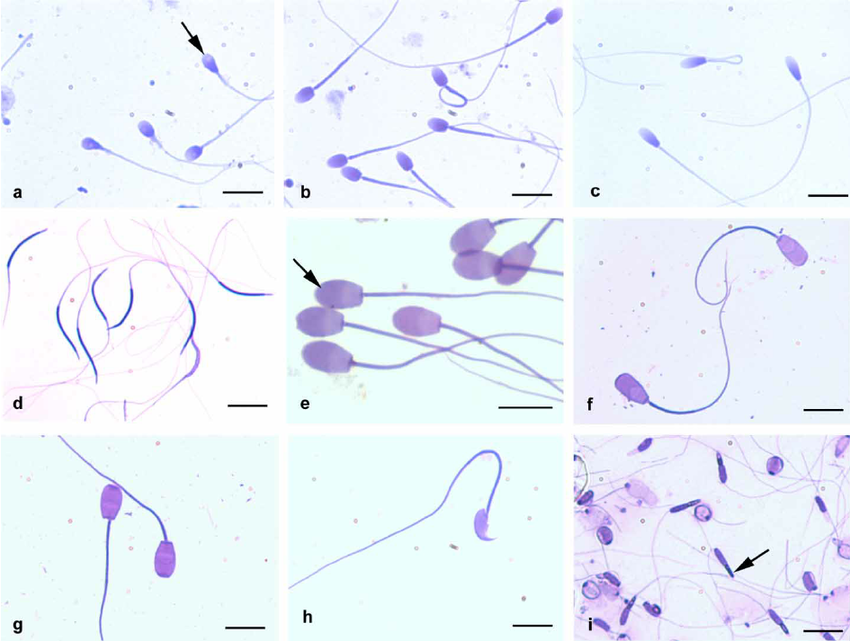 best of Sperm morphology Human