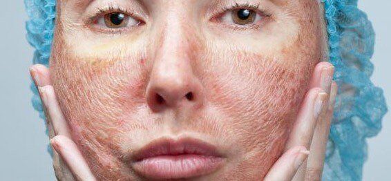 Sub reccomend Leathery facial skin