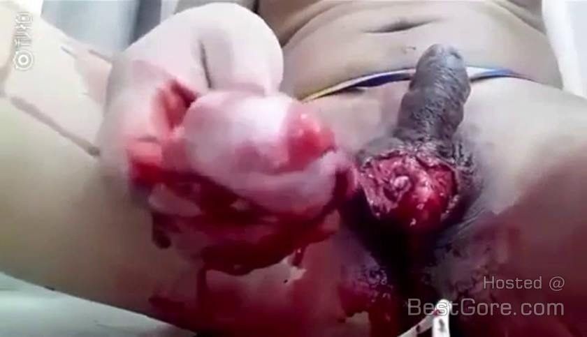ATV reccomend Male testicle castration fetish video