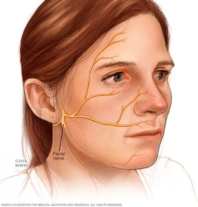 best of Damage rash Nerve facial