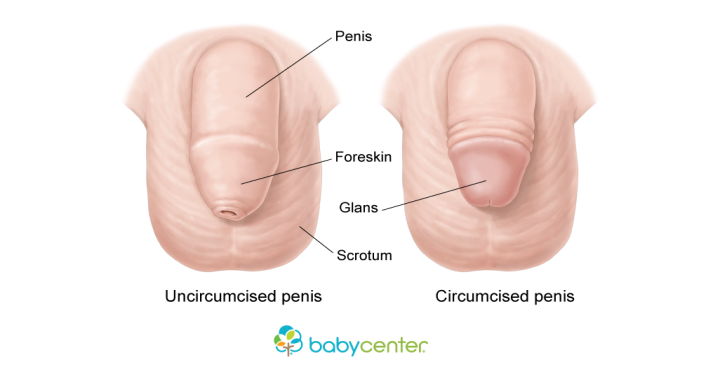 Combo reccomend Nude circumcised boy and non circumcised boy