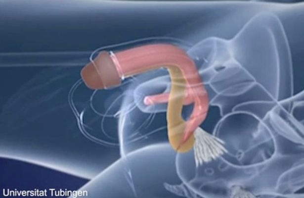 Blue B. reccomend Penis into vagina surgery