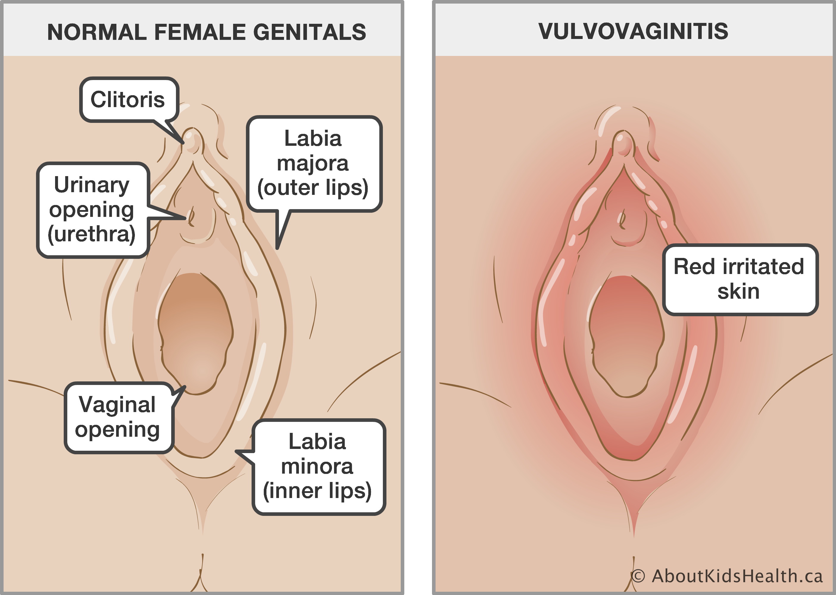 Photos girl vulva