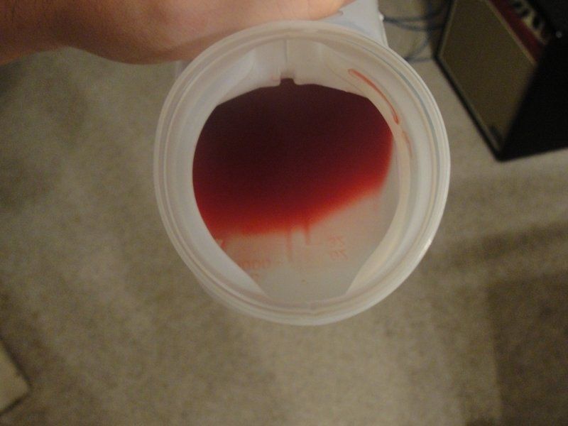Fourth D. reccomend Pissing blood pics