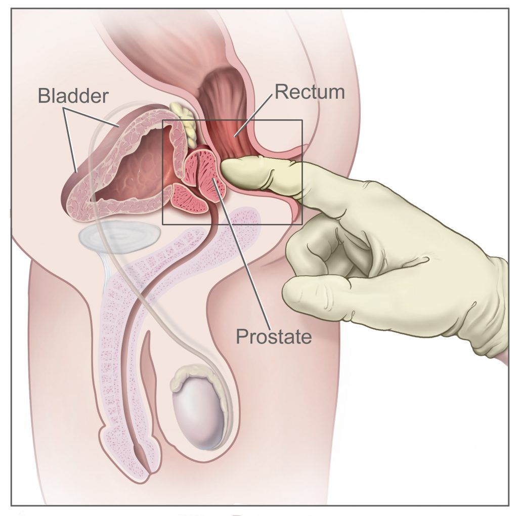 Prostate stimulation orgasm release