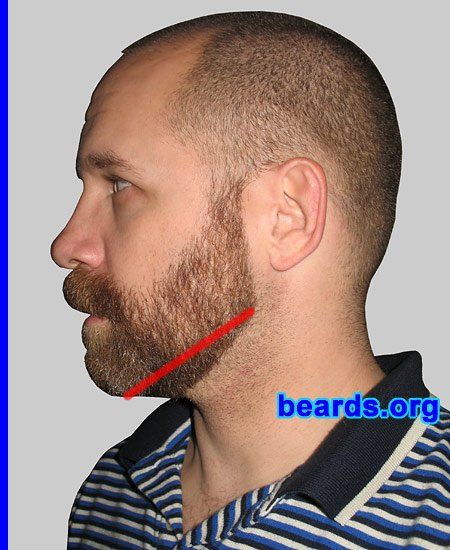 Shaved neck beard