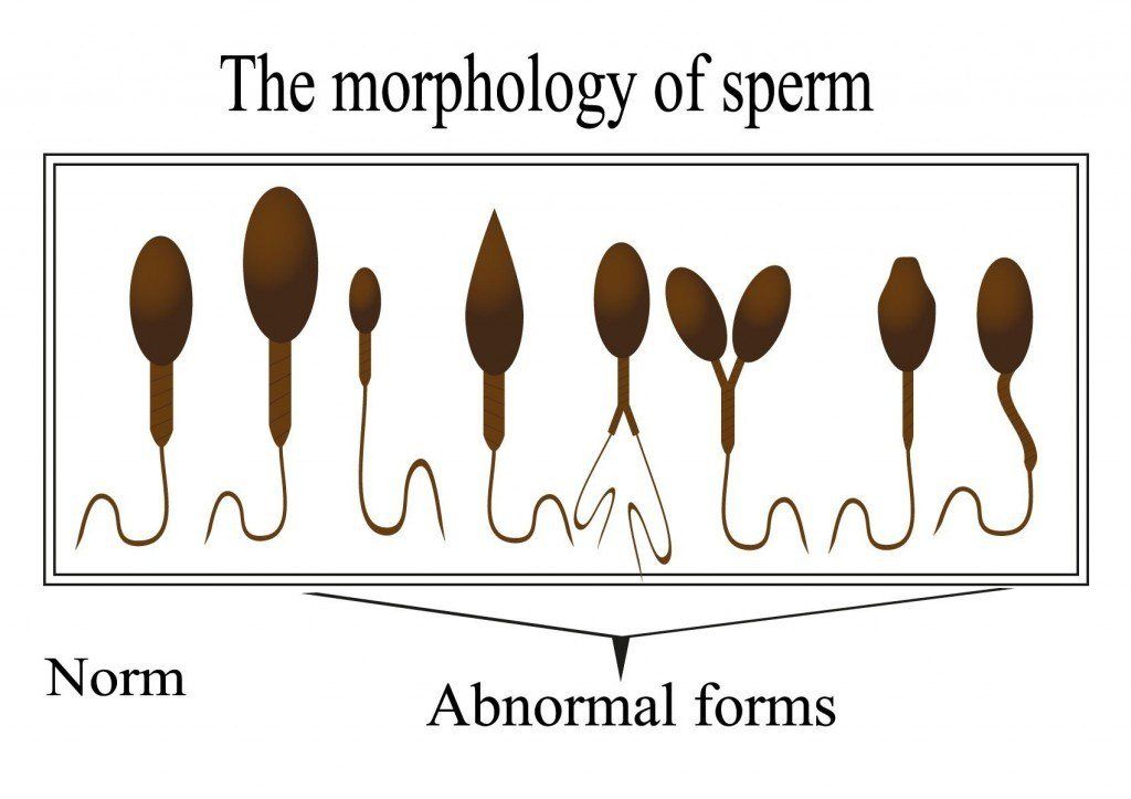 POTUS reccomend Small sperm heads